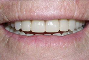 Albany GA Cosmetic Dentist