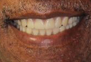 Dentist in Albany GA